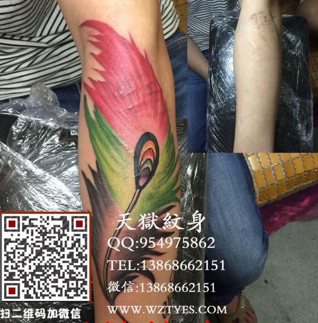 羽毛遮盖疤痕
